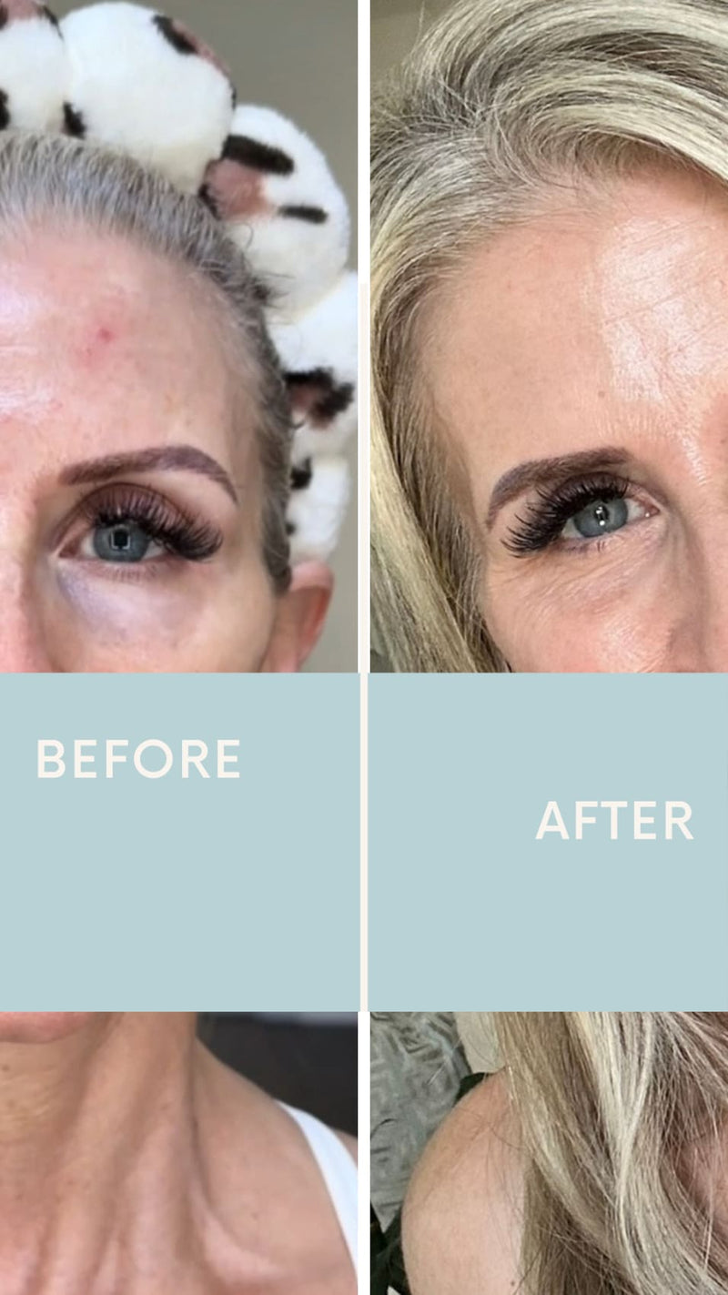 Conceal Dark Undereye Circles