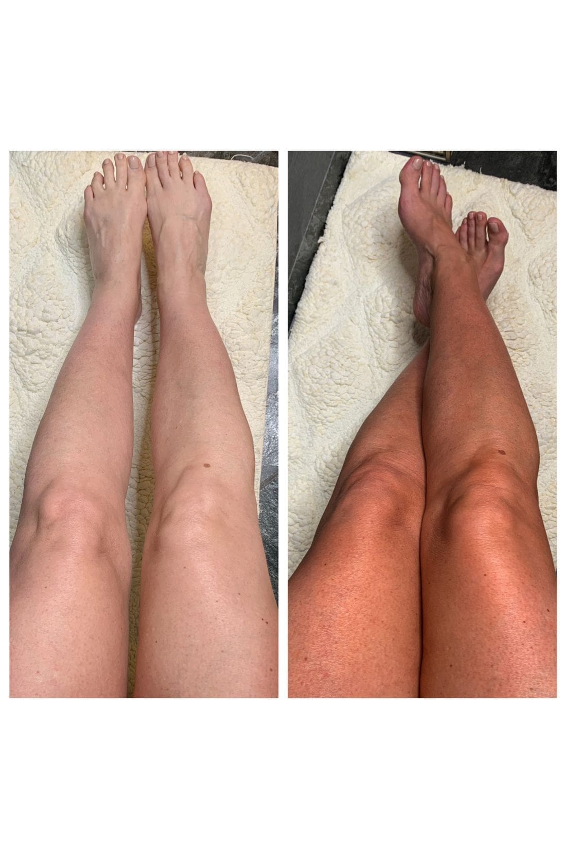 The Best Sunless Tanning Mousse