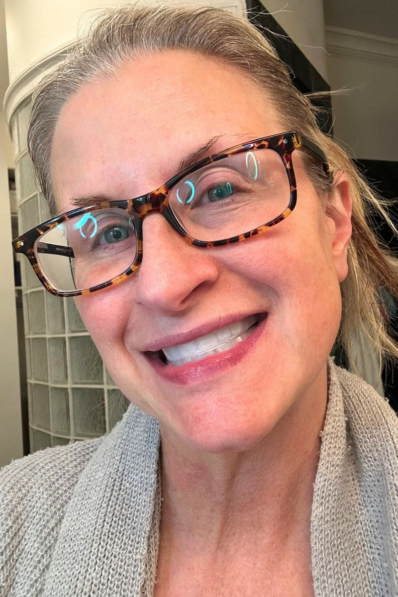 The Best Teeth Whitening Kit